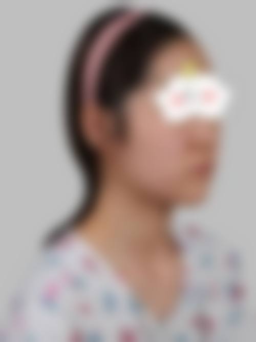 💰沭阳微悦整形医院价格