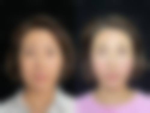 台州雍禾医疗美容诊所口碑怎么样？
