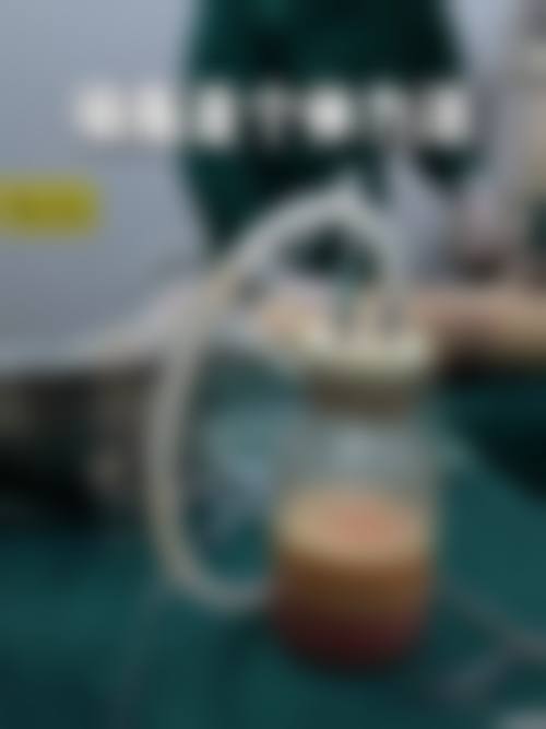 🌟沭阳微悦整形医院口碑