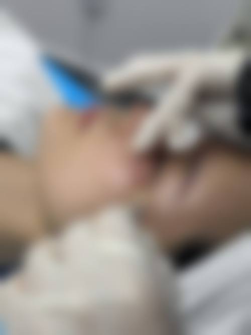 宝鸡爱容妍整形医院怎么预约？