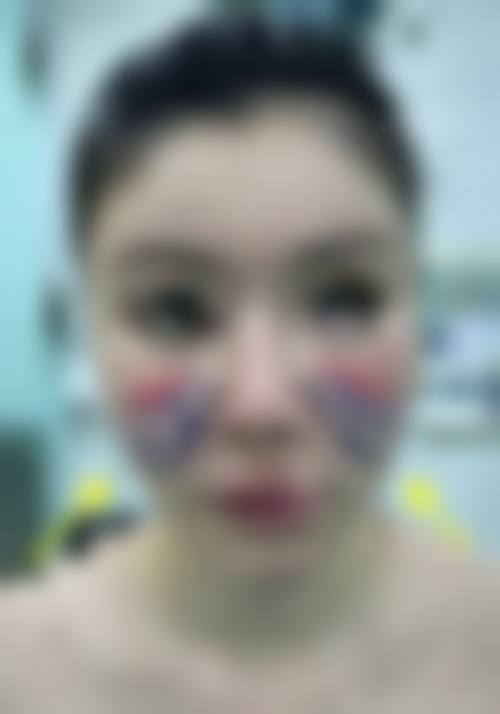 广州兰美医疗美容诊所收费价格表