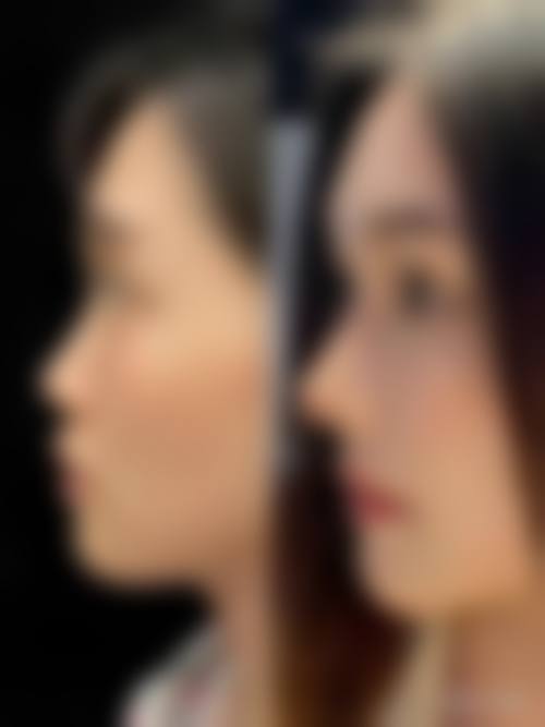【重庆市长寿区人民医院(整形外科)口碑与真实评价】