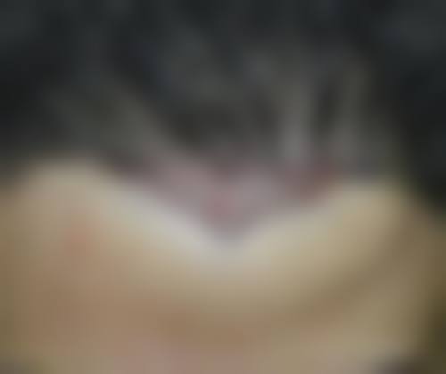 贵阳新生植发医院医院擅长什么?
