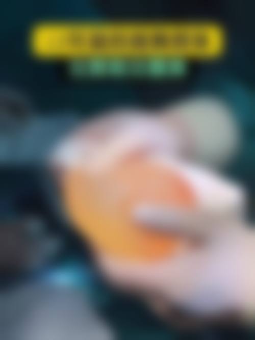 不同隆鼻时间取出耳软骨的修复差异