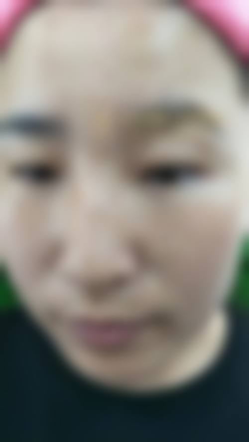 吕影医生擅长项目