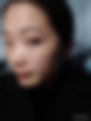 二、去痣方法大盘点