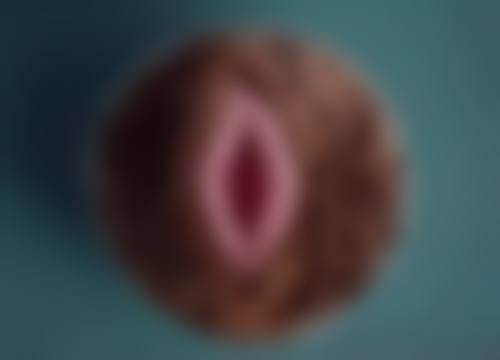 微创双眼皮修复时间