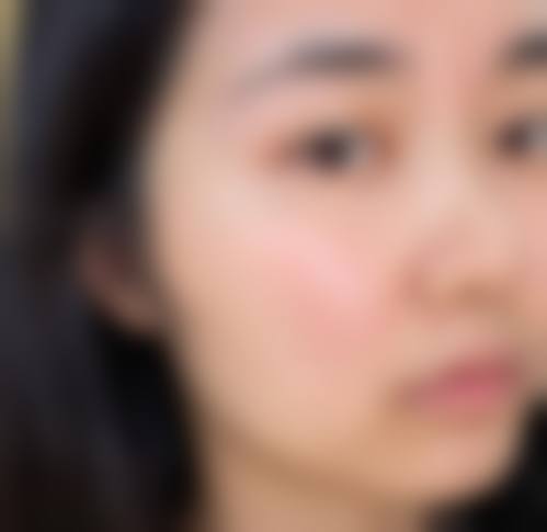 去掉眼部有眼袋同黑色素的注意事项