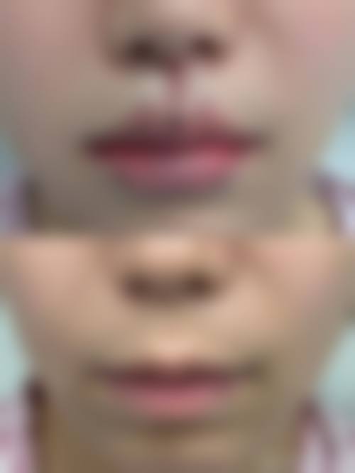沈阳中韩美丽城整形医院真人口碑评价怎么样?