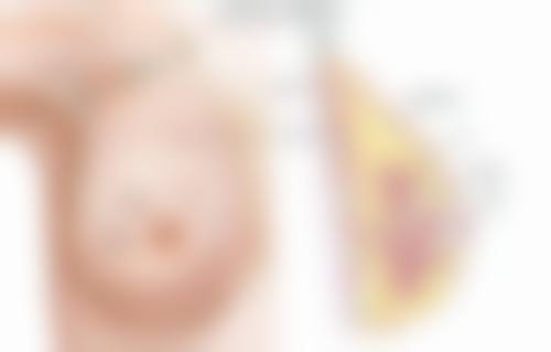 术后护理与精切双眼皮修复自然时间的关系