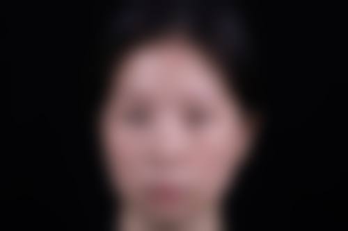 先天性眼袋能去除吗？可通过内切祛眼袋、激光等医美方式，找正规机构专业医生操作