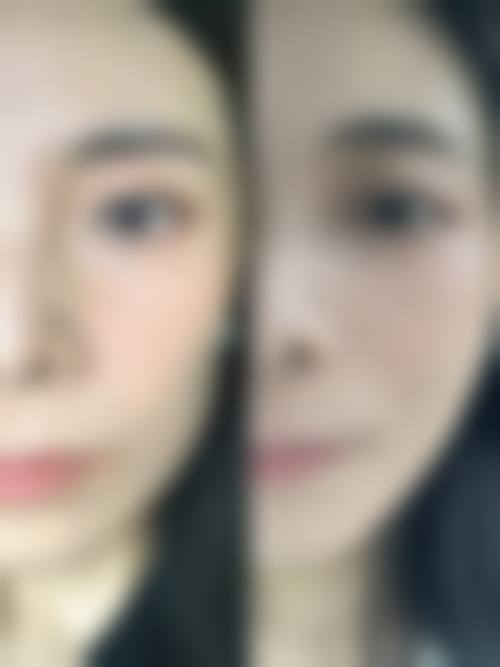 修复期注意事项
