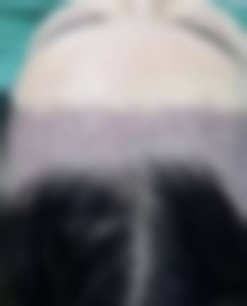 种植头发后期日常防护保养