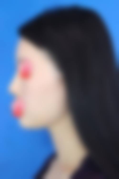 硅胶隆鼻可以一辈子不取吗？需结合自身鼻部状态、术后护理及手术医院资质判断