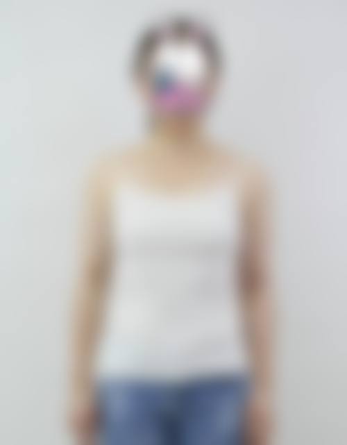 隆胸的假体适用人群