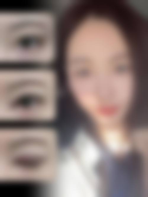 真性肉条的成因分析
