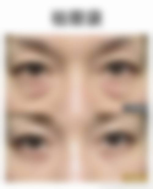 擅长项目详解
