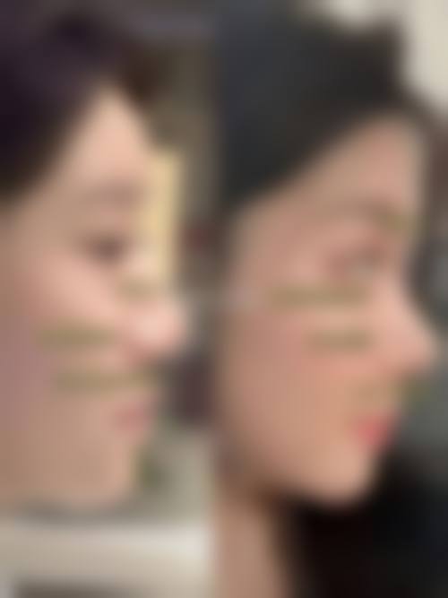 整形项目价格参考