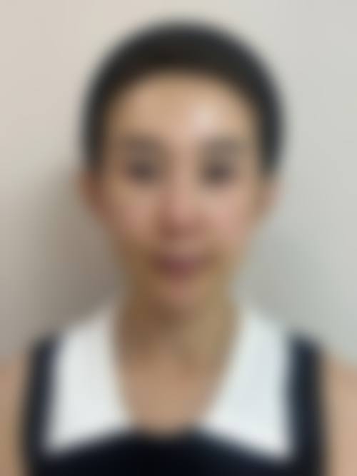 临床实例分享