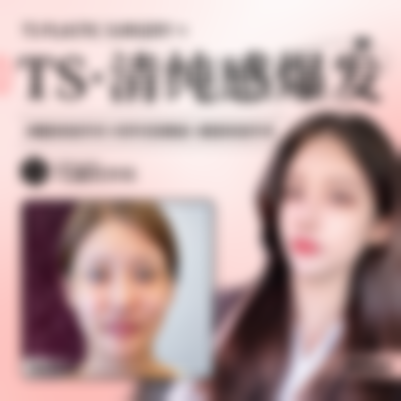 成功实例:见证韩国TS整形的实力