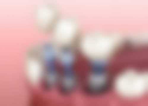 临床实例分享