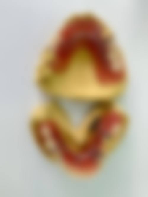 临床实例分享