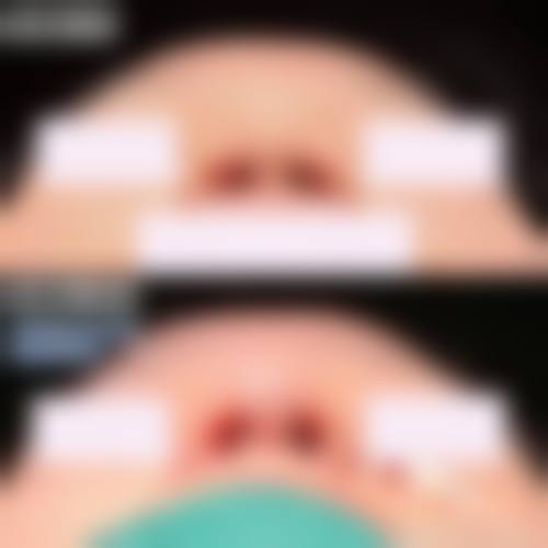 预约优惠活动