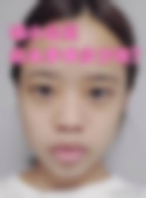 擅长项目详解