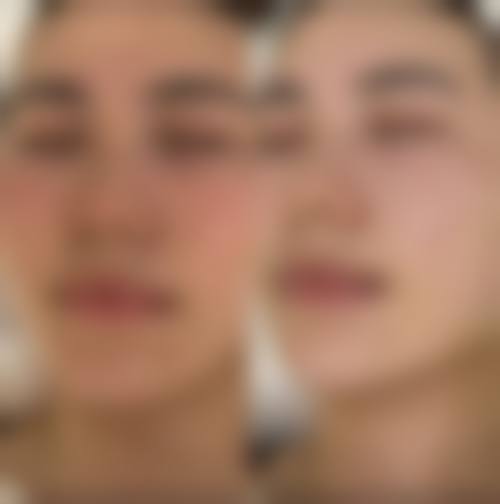 擅长项目详解