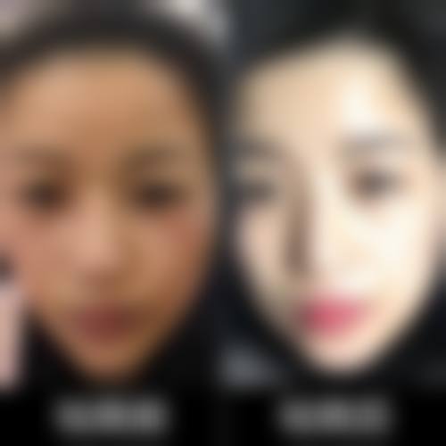 深圳星荟丽格医疗美容诊所:便捷预约开启美颜之旅