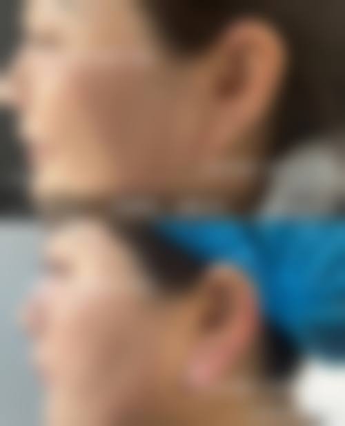 擅长项目详解