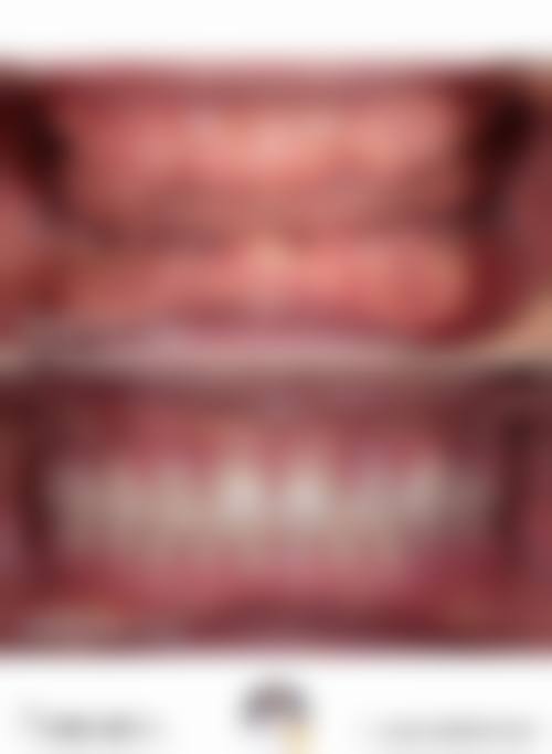预约优惠活动:现在预约程名子医生有什么优惠?