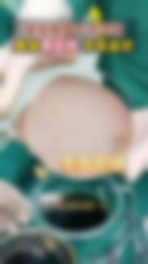 鼻修复项目的独特之处