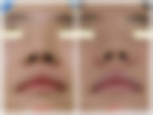 结尾总结与预约号召