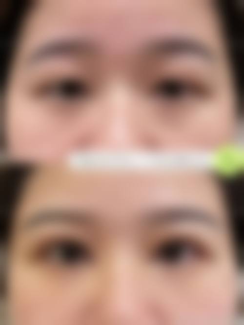 二、上海伊莱美医疗美容医院的技术实力如何