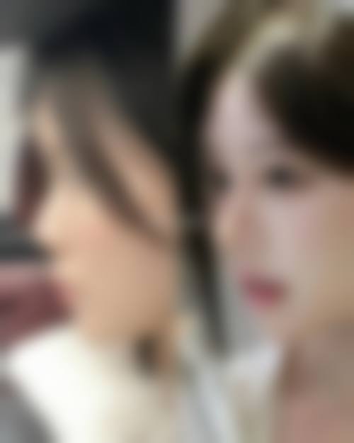 五、上海伊莱美医疗美容医院有成功实例吗