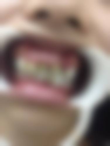 优惠活动与价格参考