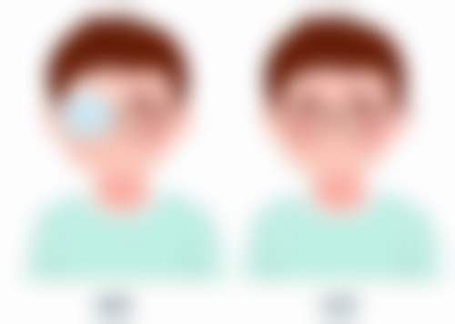 优惠活动详情:限时特别优惠,预约从速