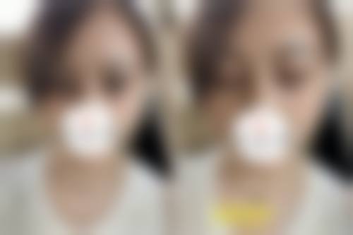 西宁澳丽整形美容医院