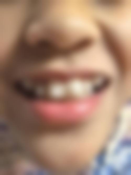 常见问题解答