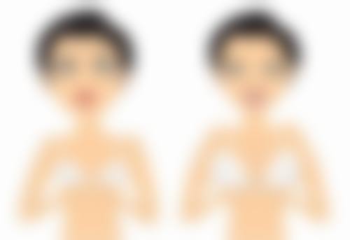 增生疤痕疙瘩与整形外科