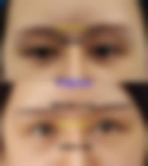 服务流程:从询问到术后,全程一对一跟进