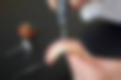 特色科室与核心项目:种植牙与牙齿矫正