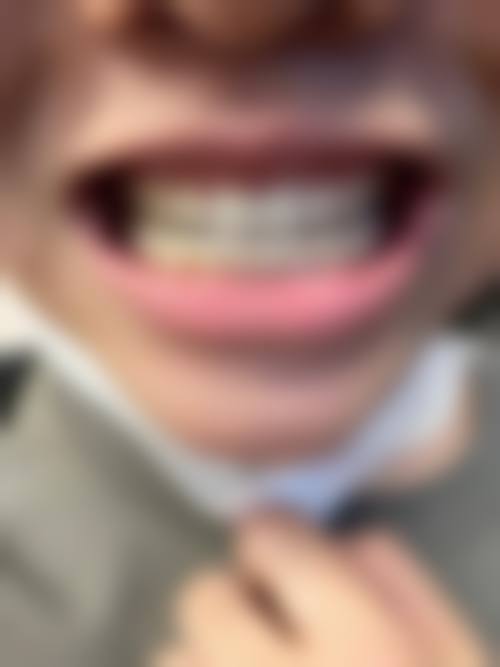 擅长项目详解