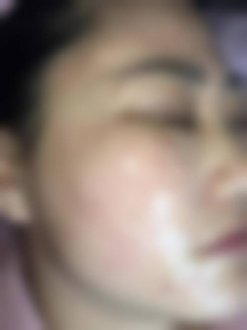 患者真实评价