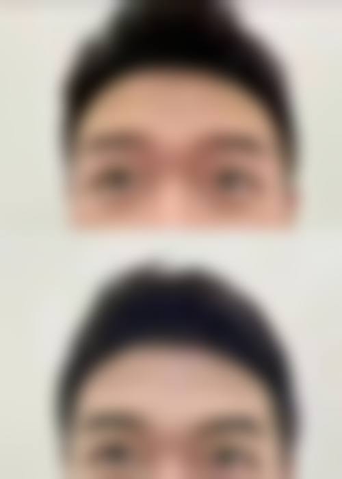 临床实例分享
