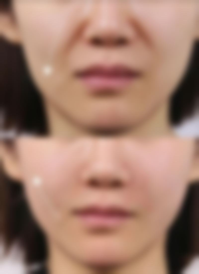 楼晓莉医生擅长项目