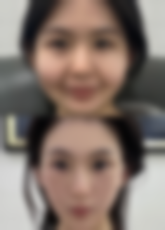 增生疤痕疙瘩与修复科