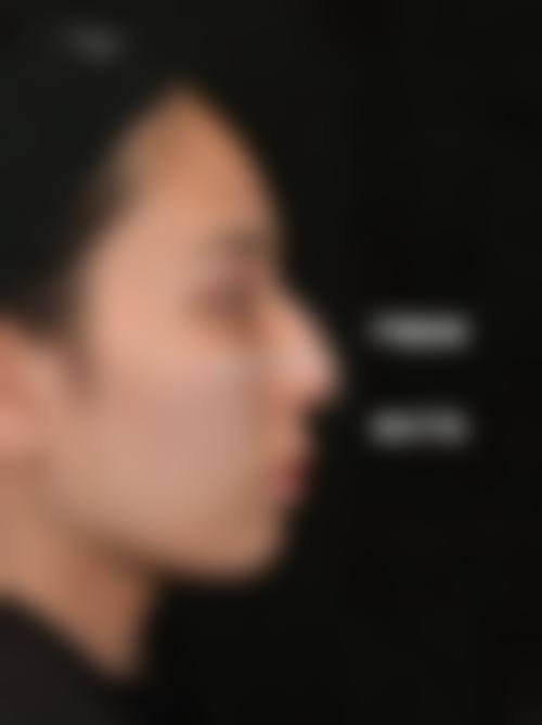 优惠活动详情