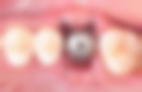 总结：选择正规口腔，收获自信笑容